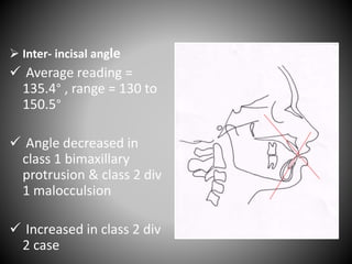  Inter- incisal angle
 Average reading =
135.4° , range = 130 to
150.5°
 Angle decreased in
class 1 bimaxillary
protrusion & class 2 div
1 malocculsion
 Increased in class 2 div
2 case
 