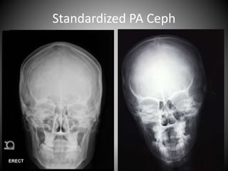 Standardized PA Ceph
 