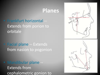 Planes
• Frankfurt horizontal --
Extends from porion to
orbitale
• Facial plane -- Extends
from nasion to pogonion
• Mandibular plane --
Extends from
cephalometric gonion to
 