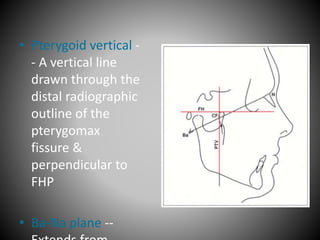• Pterygoid vertical -
- A vertical line
drawn through the
distal radiographic
outline of the
pterygomax
fissure &
perpendicular to
FHP
• Ba-Na plane --
 