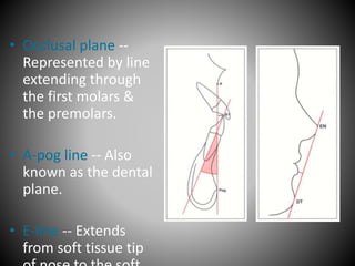 • Occlusal plane --
Represented by line
extending through
the first molars &
the premolars.
• A-pog line -- Also
known as the dental
plane.
• E-line -- Extends
from soft tissue tip
 