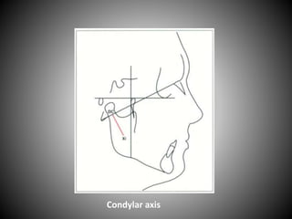 Condylar axis
 