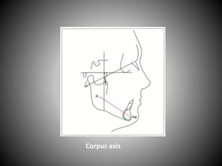 Corpus axis
 