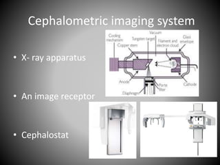 Cephalometric imaging system
• X- ray apparatus
• An image receptor
• Cephalostat
 