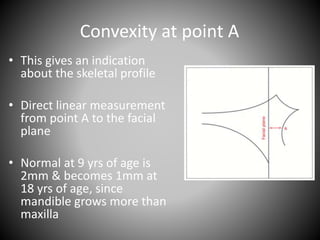 Convexity at point A
• This gives an indication
about the skeletal profile
• Direct linear measurement
from point A to the facial
plane
• Normal at 9 yrs of age is
2mm & becomes 1mm at
18 yrs of age, since
mandible grows more than
maxilla
 