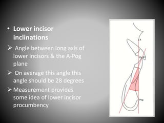 • Lower incisor
inclinations
 Angle between long axis of
lower incisors & the A-Pog
plane
 On average this angle this
angle should be 28 degrees
 Measurement provides
some idea of lower incisor
procumbency
 
