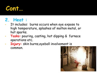 2. Heat :
• It includes: burns occurs when eye expose to
high temperature, splashes of molten metal, or
hot sparks.
• Tasks: pouring, casting, hot dipping & furnace
operations etc.
• Injury: skin burns,eyeball involvement is
common.
 
