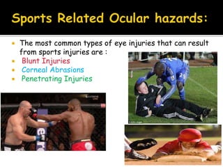  The most common types of eye injuries that can result
from sports injuries are :
 Blunt Injuries
 Corneal Abrasions
 Penetrating Injuries
 