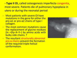 - Type II OI, called osteogenesis imperfecta congenita,
most severe. Patients die of pulmonary hypoplasia in
utero or during the neonatal period
- Most patients with severe OI have
mutations in the gene for either the
pro-α1 or pro-α2 chains of type I
collagen.
- The most common mutations cause
the replacement of glycine residues
(in –Gly–X–Y–) by amino acids with
bulky side chains. T
- The resultant structurally abnormal
pro-α chains prevent the formation
of the required triple-helical
conformation.
 