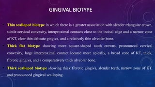 Slender Tooth Classifectoin of periodntal disaese part 2.pptx