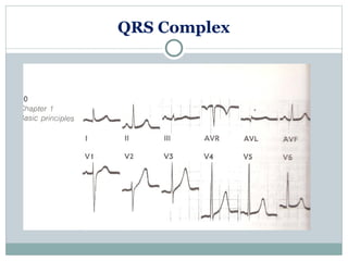 LEC.03. Basics of Electrocardiography, Arrhythmia & Pacemaker.ppt