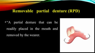 Lec.1 Removable Partial Denture (Terms and Components).pptx