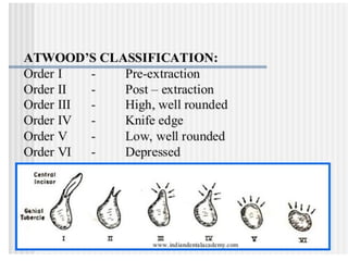 Comprehensive Overview of Residual Ridge Resorption in Dentistry | PPTX