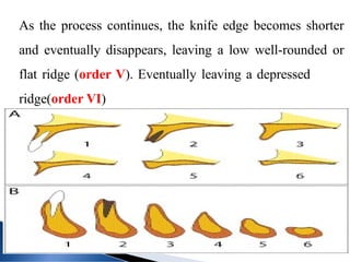 Comprehensive Overview of Residual Ridge Resorption in Dentistry | PPTX