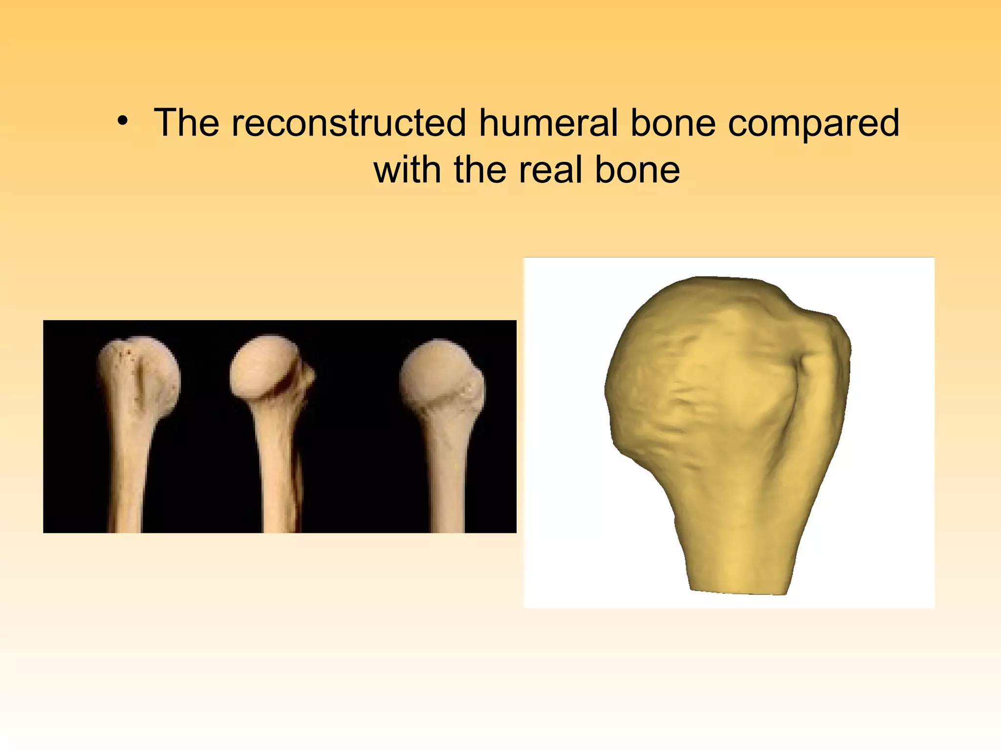 • The reconstructed humeral bone compared
              with the real bone
 