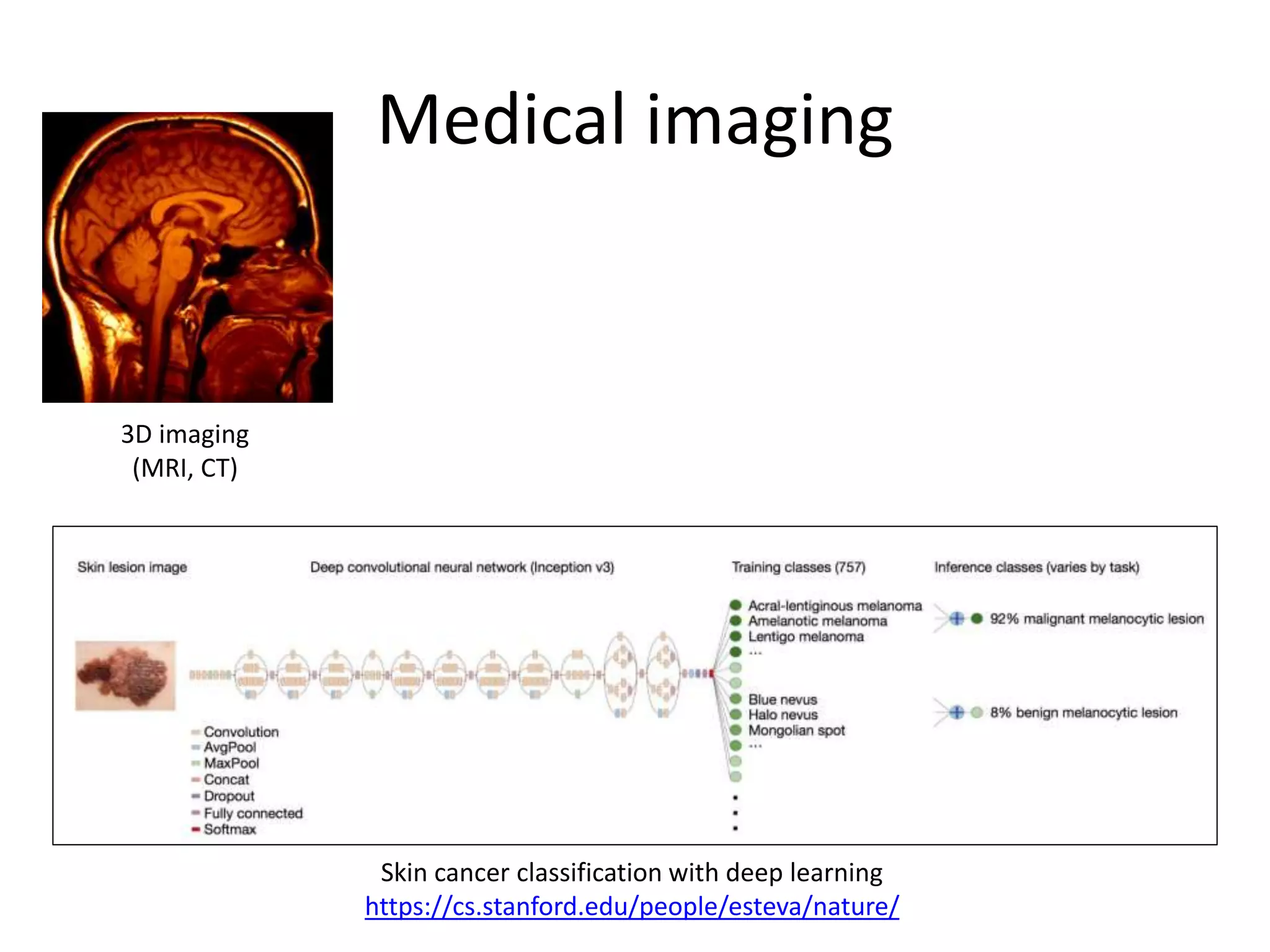 Medical imaging
3D imaging
(MRI, CT)
Skin cancer classification with deep learning
https://cs.stanford.edu/people/esteva/nature/
 