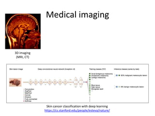 Medical imaging
3D imaging
(MRI, CT)
Skin cancer classification with deep learning
https://cs.stanford.edu/people/esteva/nature/
 