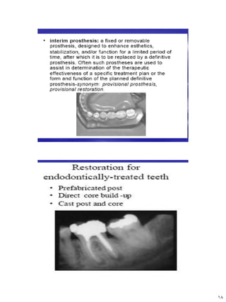 [Crown & Bridges] [terminology & classification] | PDF