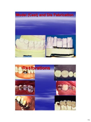 [Crown & Bridges] [terminology & classification] | PDF