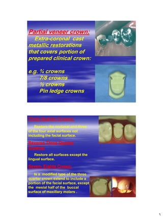 [Crown & Bridges] [terminology & classification] | PDF