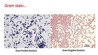 Gram stain…
 