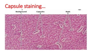 Capsule staining…
 