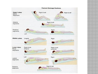 Comprehensive Airway Secretion Management and Clearance Techniques in ...