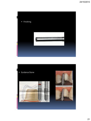 24/10/2013
21
 Finishing
 Guidance Stone
 