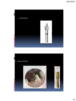 24/10/2013
22
 Root Facer
 TissueTrimmer
 