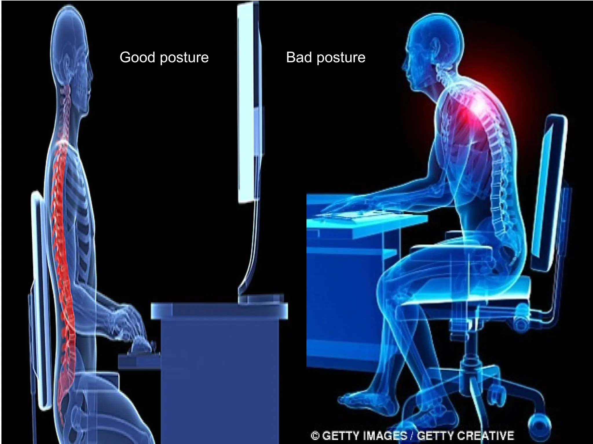 Good posture Bad posture
 