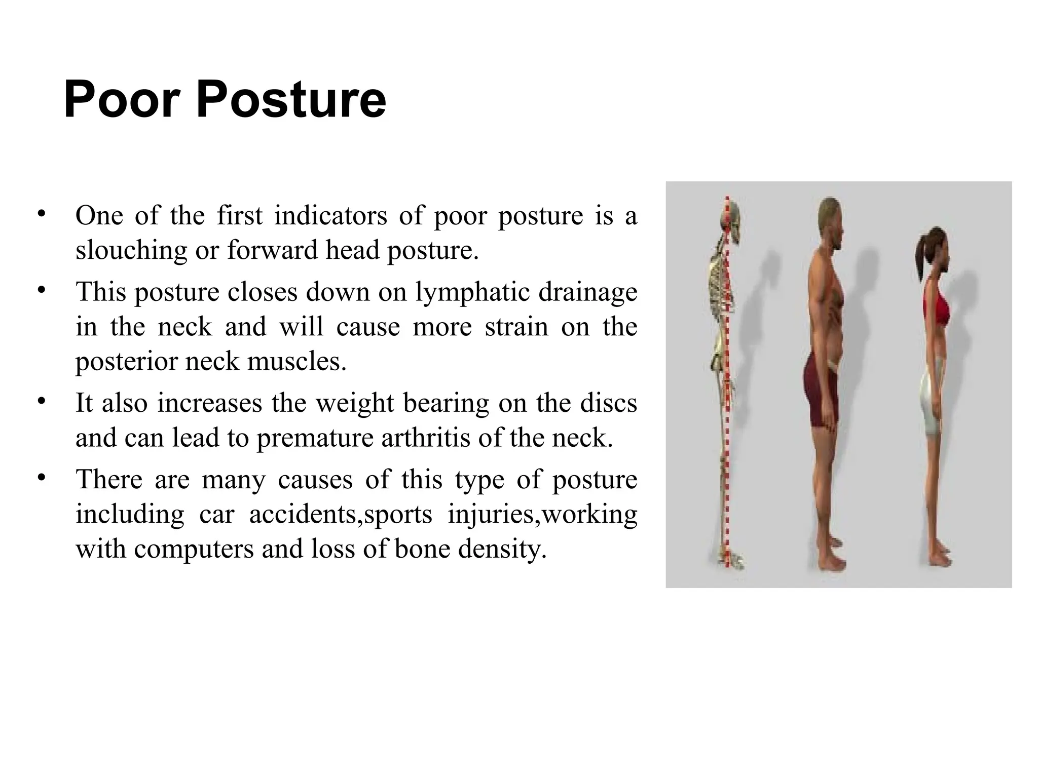 Poor Posture
• One of the first indicators of poor posture is a
slouching or forward head posture.
• This posture closes down on lymphatic drainage
in the neck and will cause more strain on the
posterior neck muscles.
• It also increases the weight bearing on the discs
and can lead to premature arthritis of the neck.
• There are many causes of this type of posture
including car accidents,sports injuries,working
with computers and loss of bone density.
 