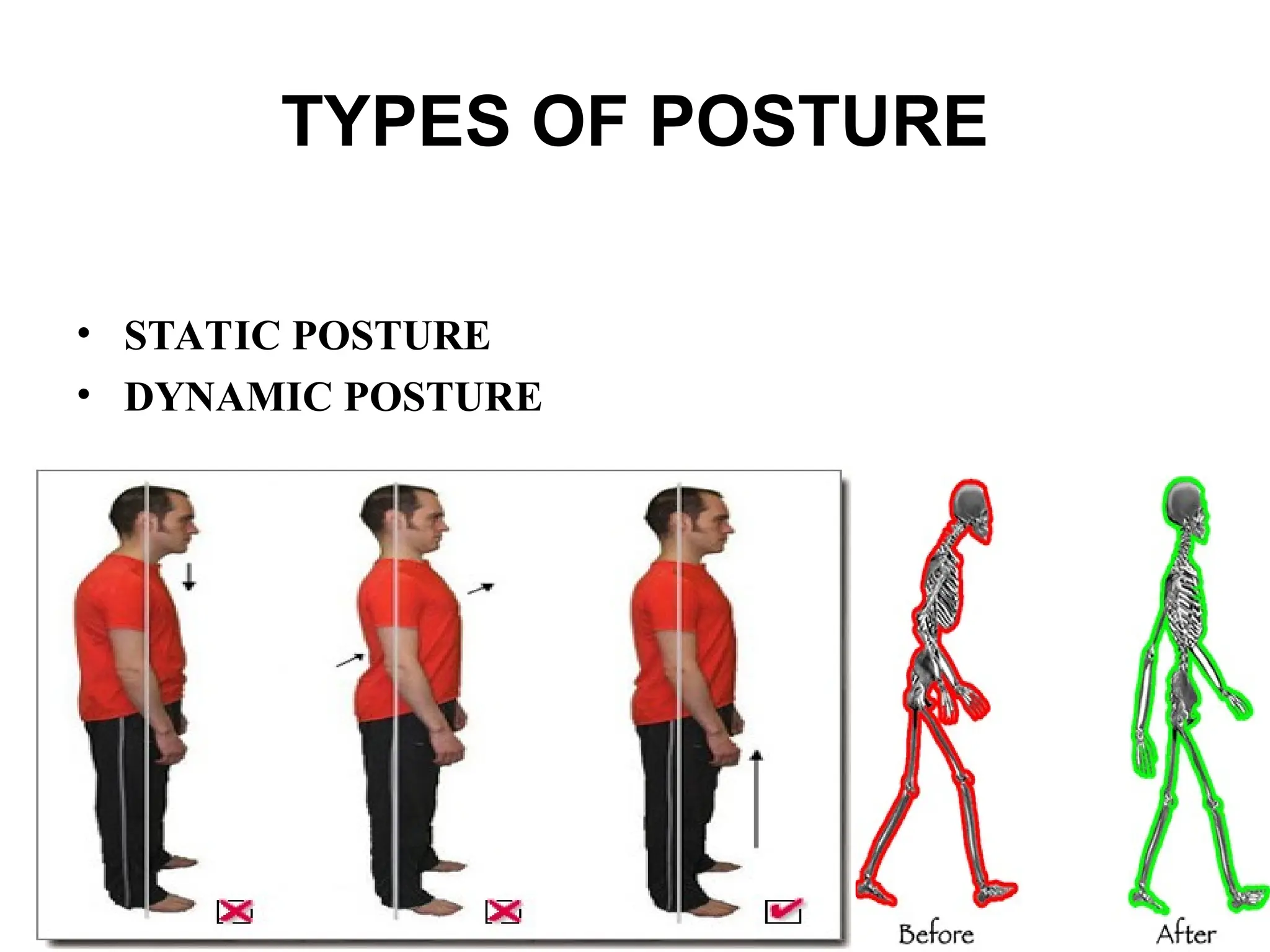 TYPES OF POSTURE
• STATIC POSTURE
• DYNAMIC POSTURE
 