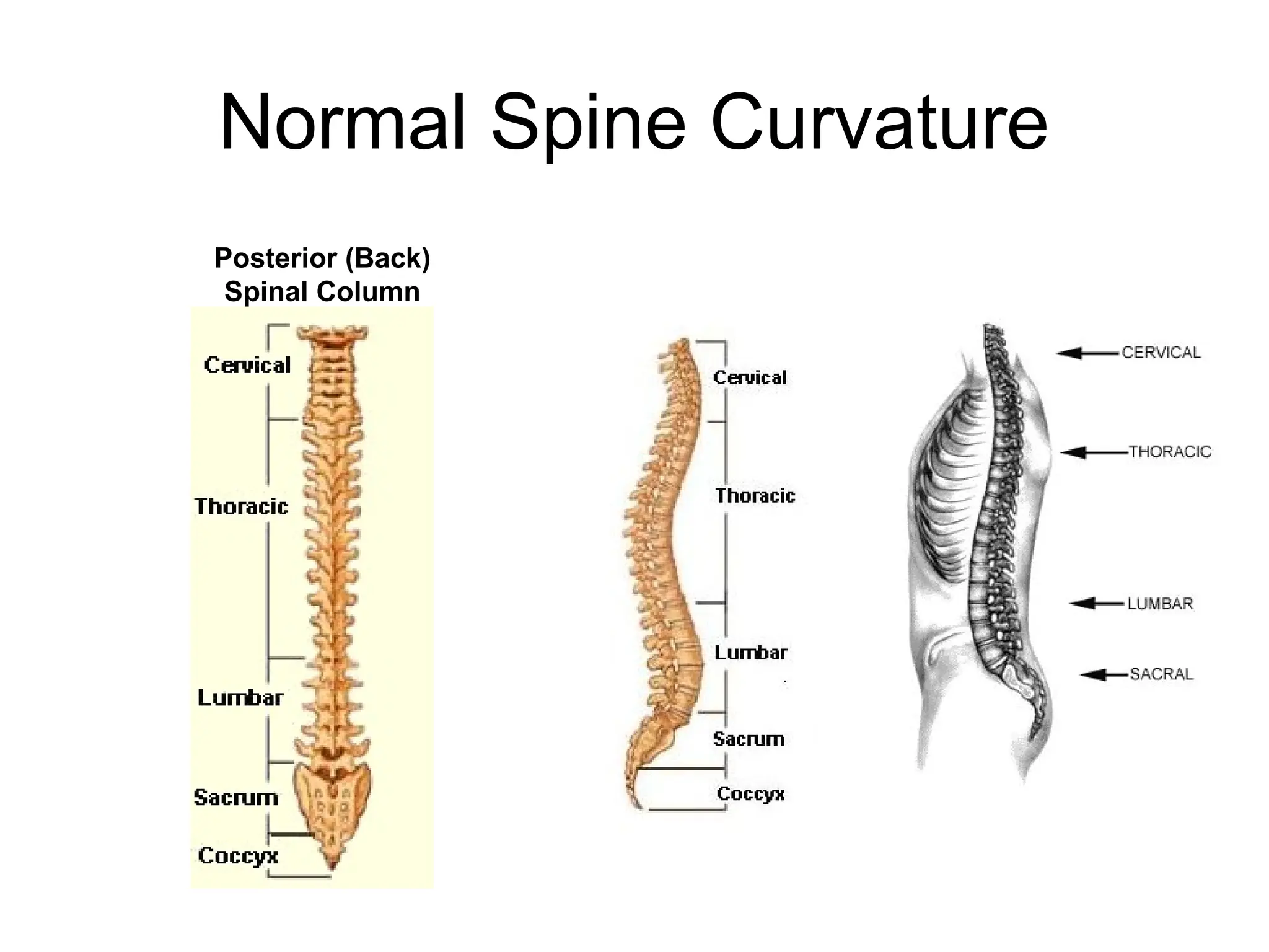 Normal Spine Curvature
Posterior (Back)
Spinal Column
 