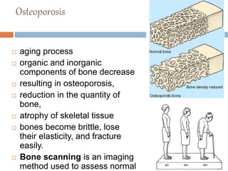 BONES Lecture 7 | PPTX