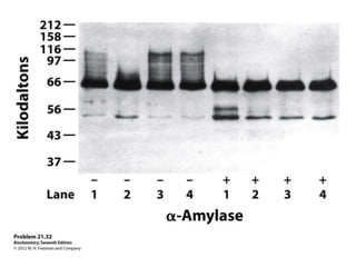 Lec09 glycogen met