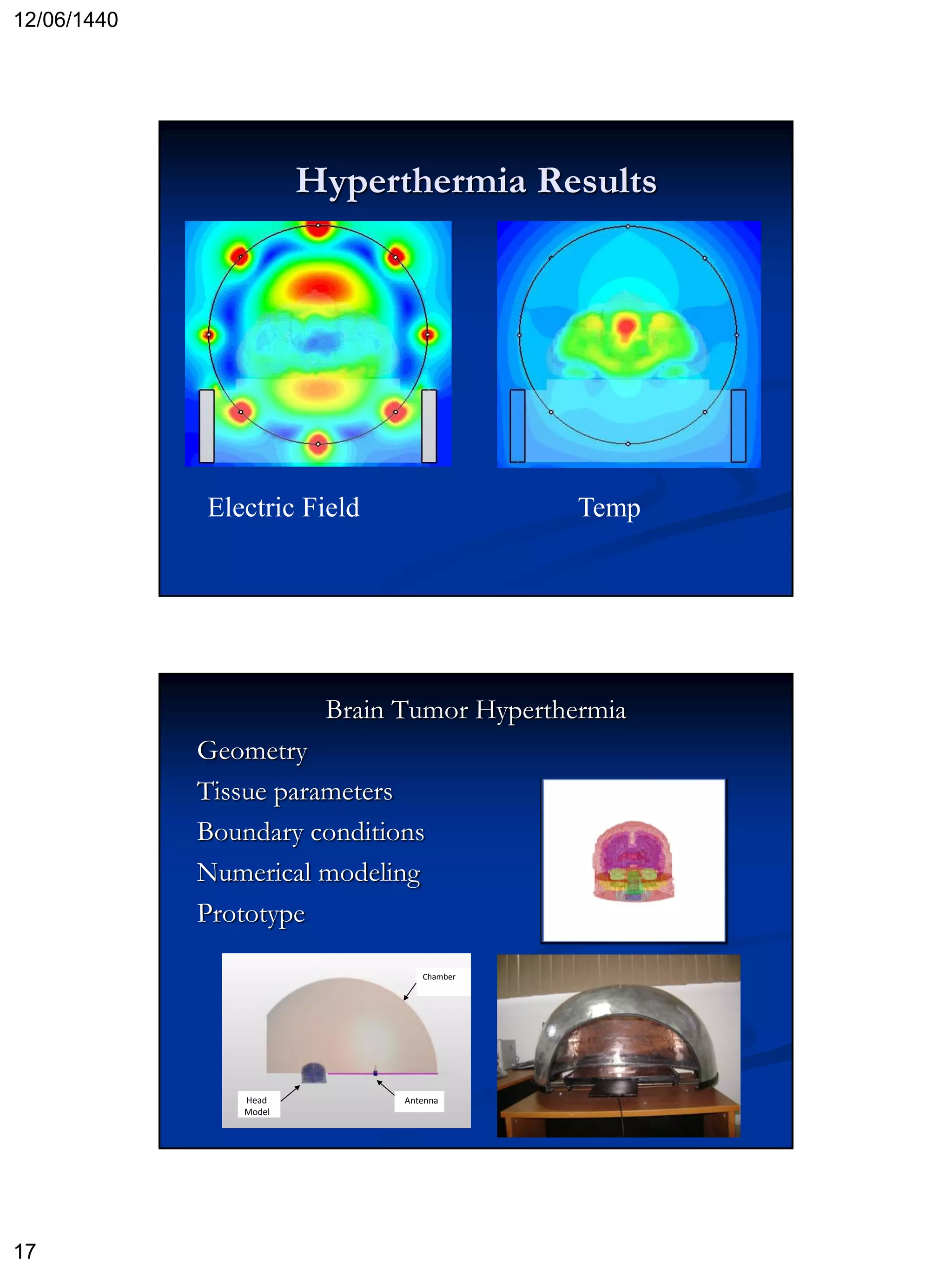 12/06/1440
17
Hyperthermia Results
Electric Field Temp
Brain Tumor Hyperthermia
Geometry
Tissue parameters
Boundary conditions
Numerical modeling
Prototype
Head
Model
Antenna
Chamber
 