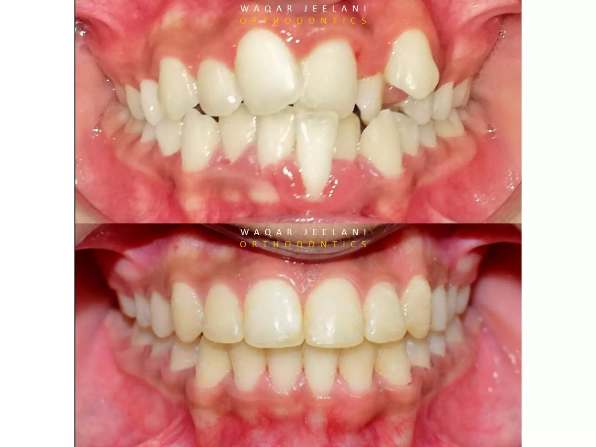 Lec 1. Introduction to Orthodontics.pdf