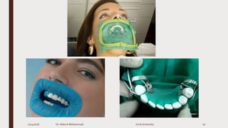 2/24/2016 Dr. HebaA Mohammad Uruk University 20
 