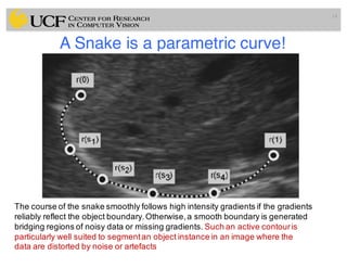 Lec11: Active Contour and Level Set for Medical Image Segmentation | PDF
