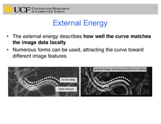 Lec11: Active Contour and Level Set for Medical Image Segmentation | PDF
