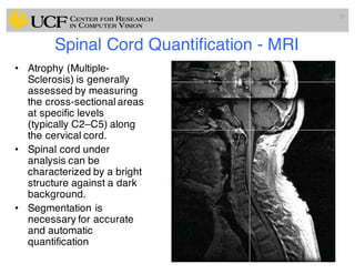 Lec11: Active Contour and Level Set for Medical Image Segmentation | PDF