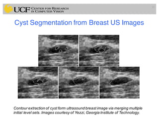 Lec11: Active Contour and Level Set for Medical Image Segmentation | PDF