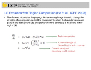 Lec11: Active Contour and Level Set for Medical Image Segmentation | PDF