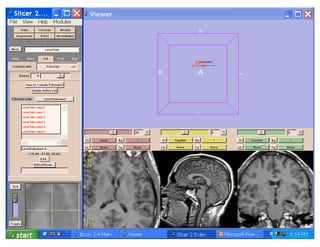 Lec11: Active Contour and Level Set for Medical Image Segmentation | PDF