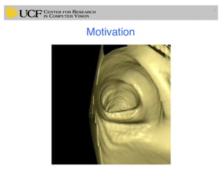 Lec11: Active Contour and Level Set for Medical Image Segmentation | PDF