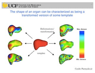 The shape of an organ can be characterized as being a
transformed version of some template
11
template
Credit: Parmedco.ir
Deformations/
transformation
 
