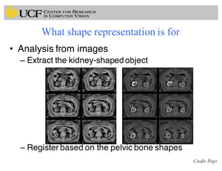 What shape representation is for
• Analysis from images
– Extract the kidney-shapedobject
– Register based on the pelvic bone shapes
Credit: Pizer
 