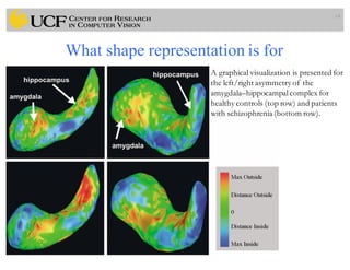What shape representation is for
14
A graphical visualization is presented for
the left/right asymmetry of the
amygdala–hippocampalcomplex for
healthy controls (top row) and patients
with schizophrenia (bottom row).
 