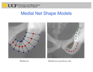 Medial Net Shape Models
Medial nets, positions onlyMedial net
 