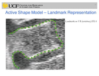 Active Shape Model – Landmark Representation
24
Landmarks on VB (vertabrae),DXA
 
